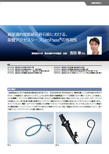 経尿道的尿管砕石術?安全・確実なTULの手術手技 経尿道的尿管砕石術−安全・確実なTULの手術手技 | 松崎 順一
